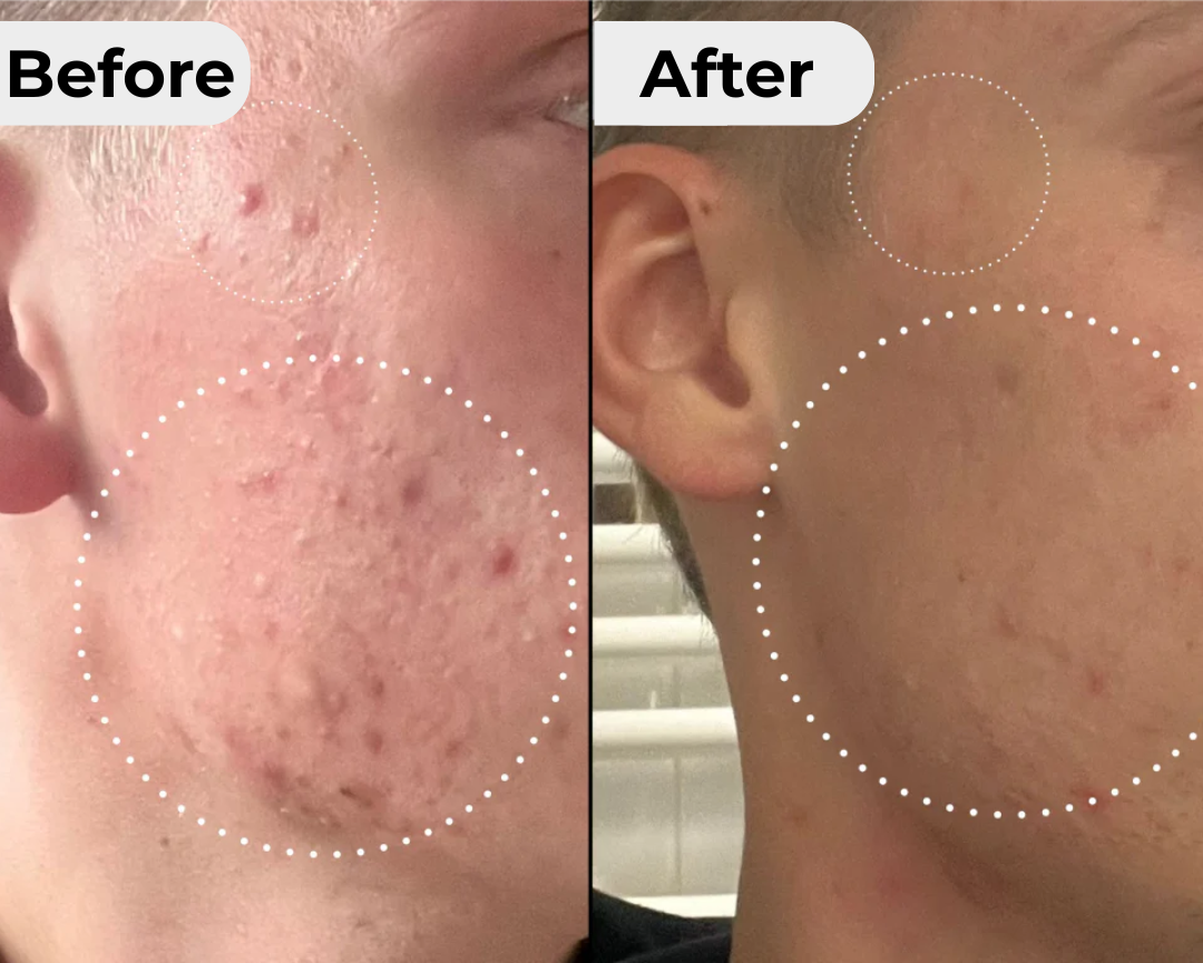 Tallow 2.0 Facial Cream™️ 50ml