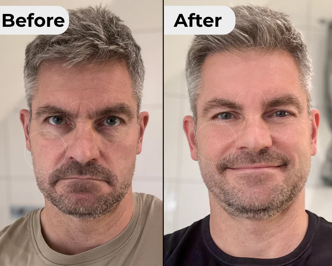 Tallow 2.0 Facial Cream™️ 50ml